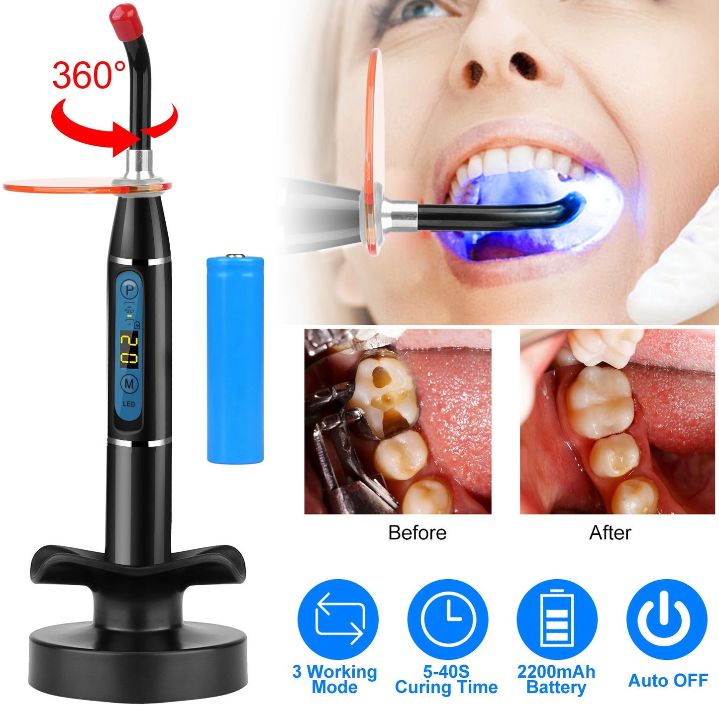 5W Cordless Dental LED Curing Light Lamp