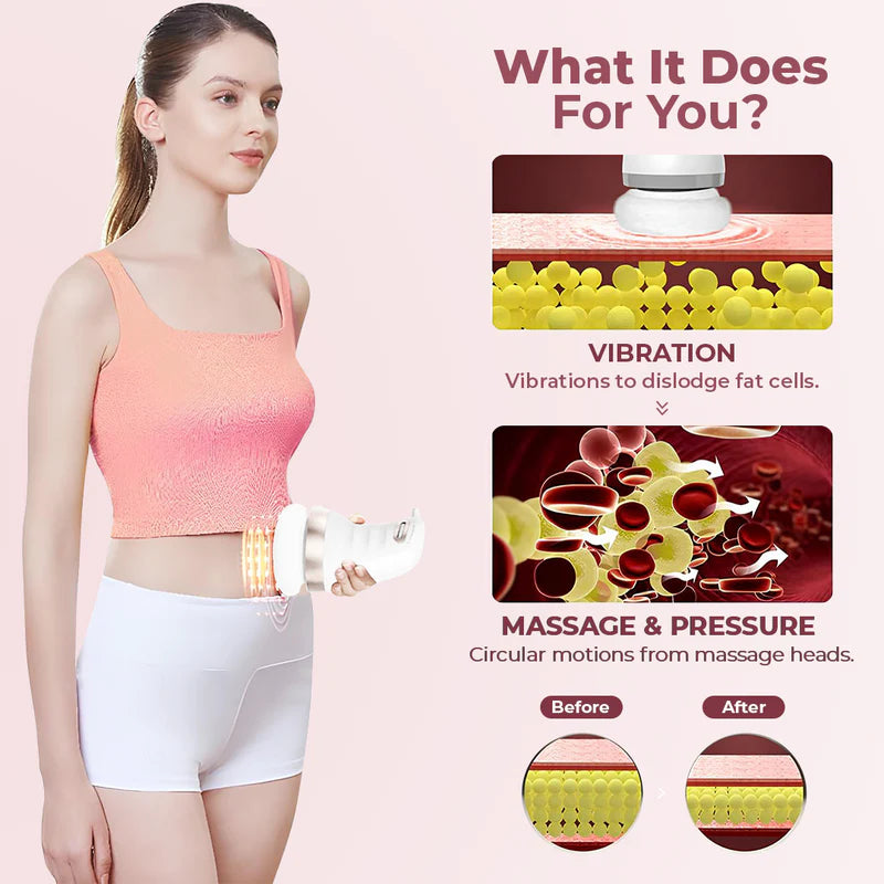 Electric Body Cellulite Toning Massager