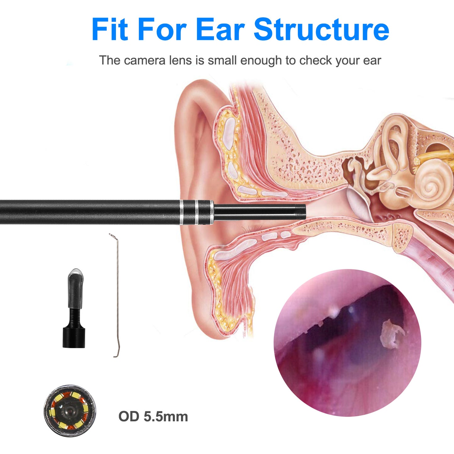 Ear Cleaning Endoscope Camera