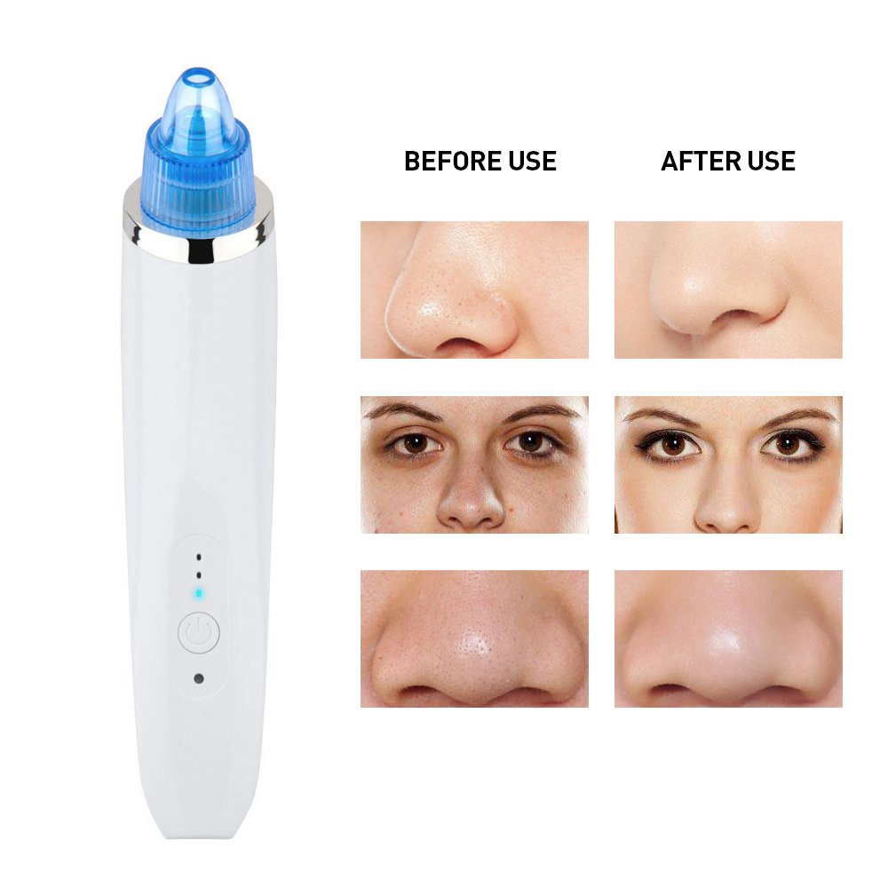 Electronic Vacuum Blackhead Remover
