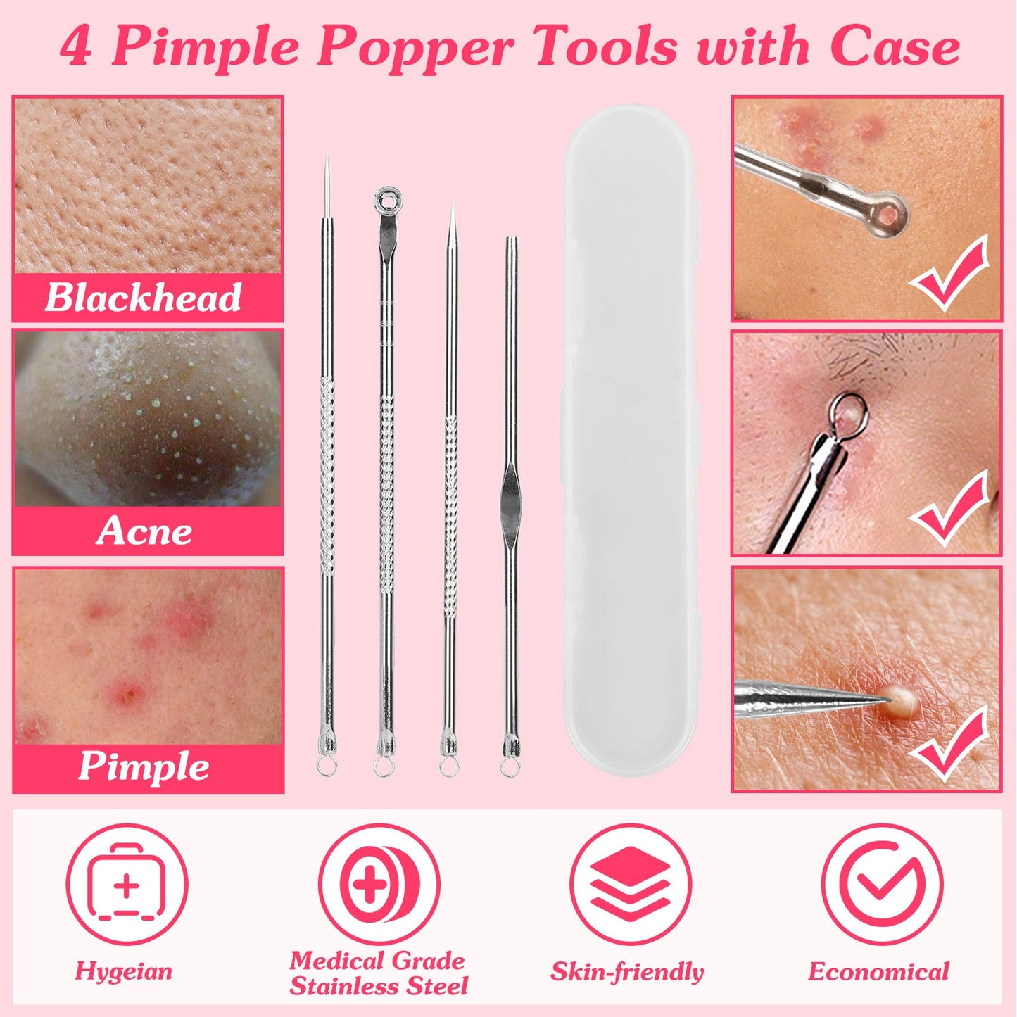 Hot Compress Blackhead Remover