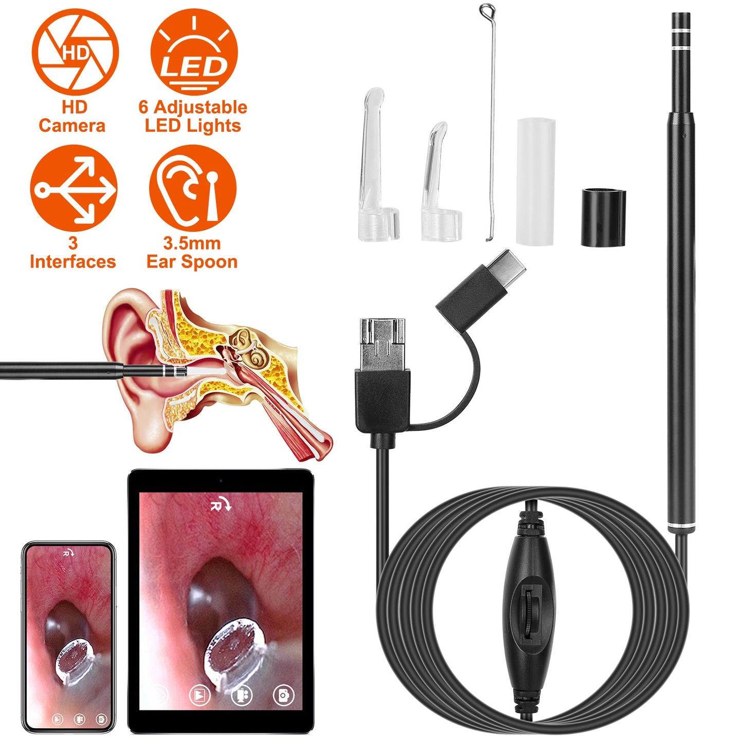 Ear Endoscope Wax Remover