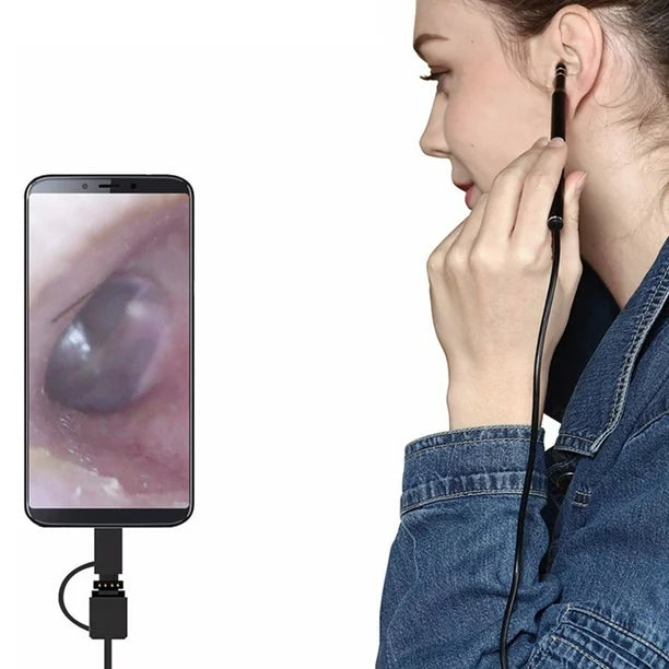 Ear Cleaning Endoscope Camera