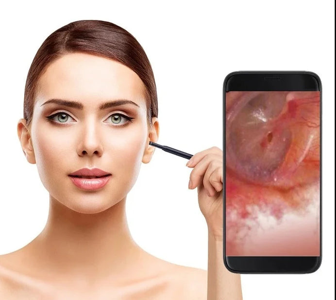 Ear Cleaning Endoscope Camera