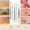 5Pcs Blackhead Remover Kit